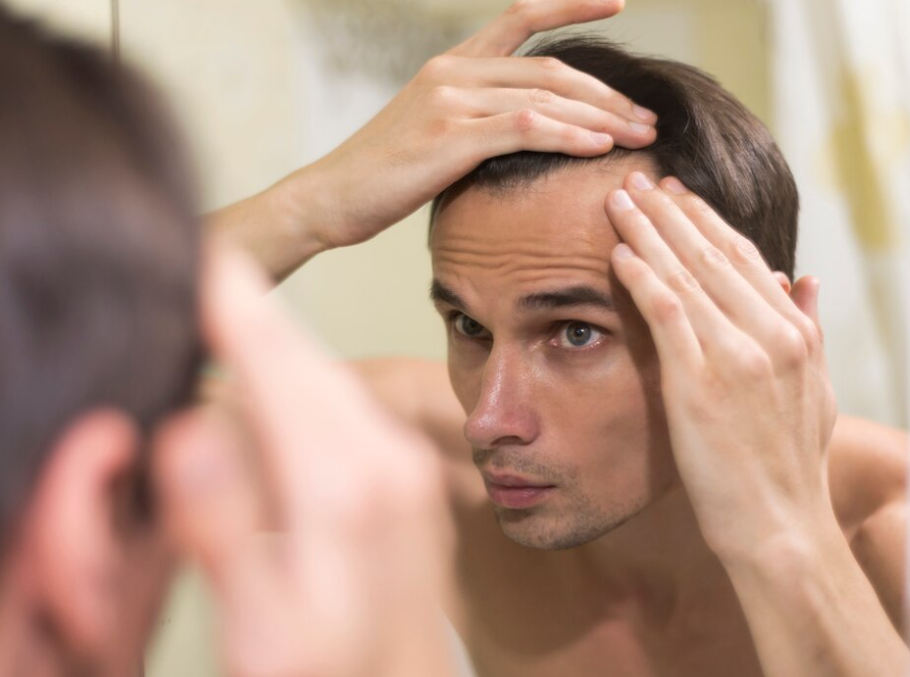 Soin des Cheveux pour Hommes : Prévenir et Réduire la Chute des Cheveux